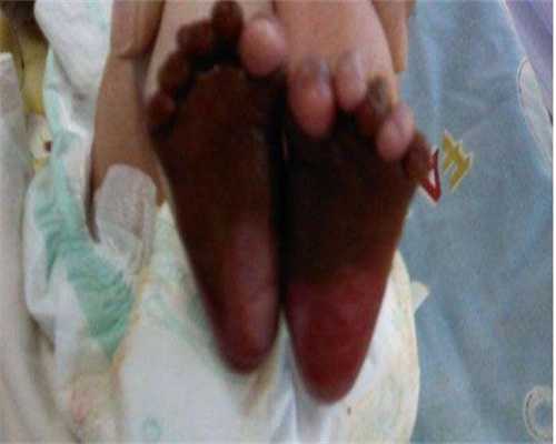 中山供卵中介公司有几家供卵医院坤和代怀网